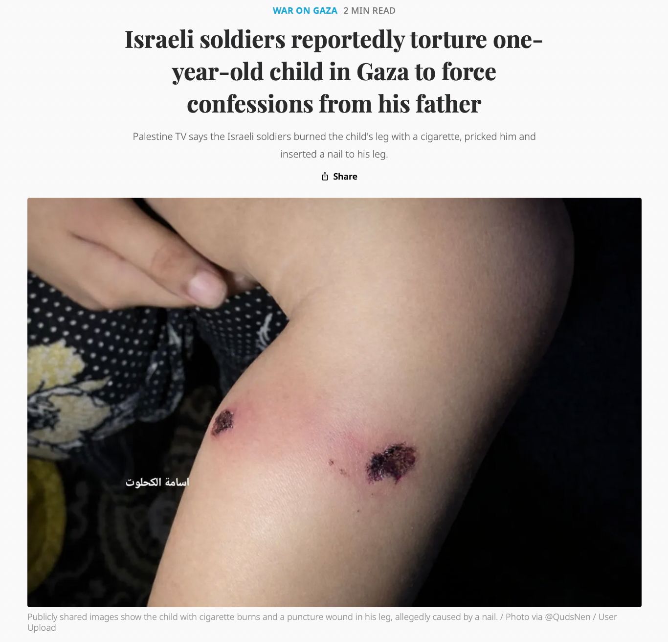TRT World griff die Story auf – unhinterfragt.