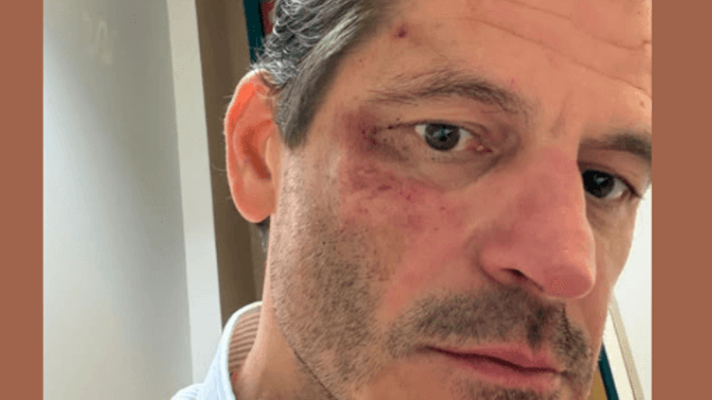 Prügelattacke auf Bürgermeister von Vösendorf: Gewalt gegen Politiker nimmt zu - news - exxpress Nachrichten