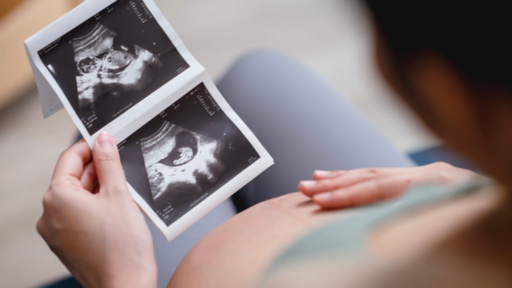 Studien schlagen Alarm: Viele Frauen fühlen sich zur Abtreibung gedrängt - news - exxpress Nachrichten