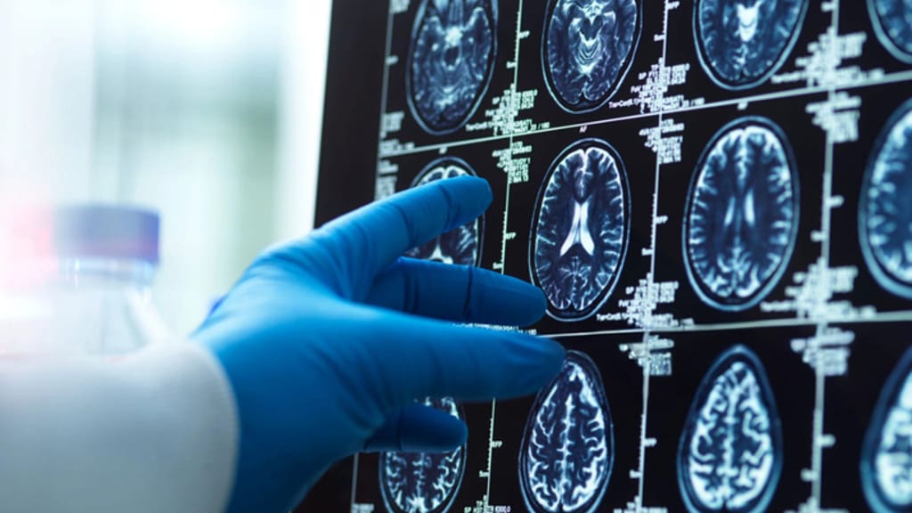 Weniger ist mehr: Warum das Gedächtnisnetzwerk im Alter gewinnt - news - exxpress Nachrichten