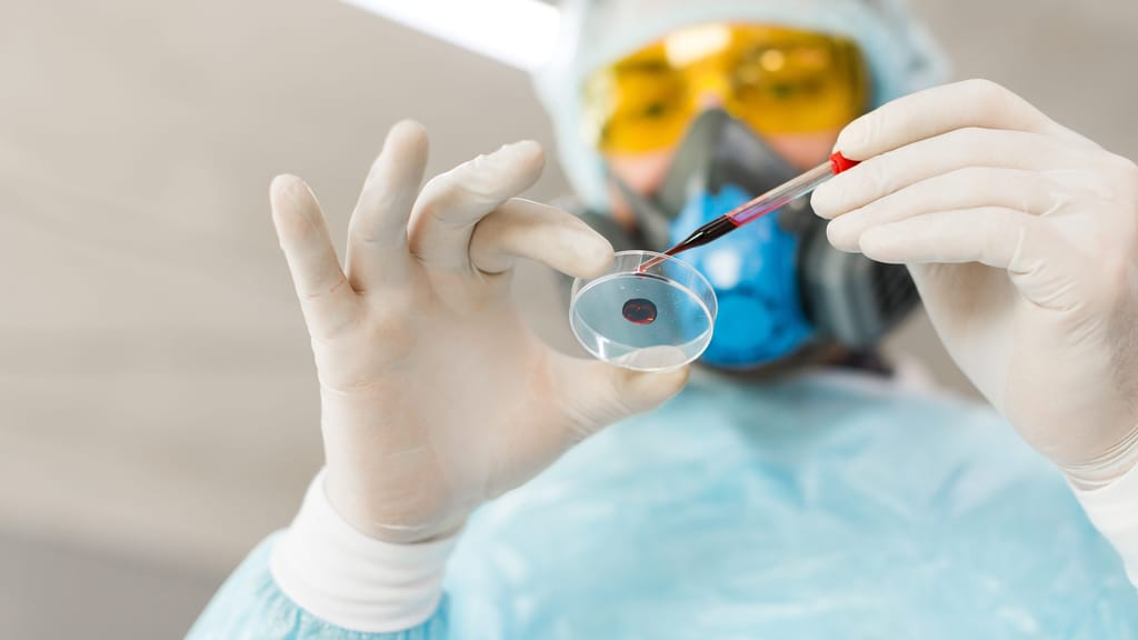 Sorge wegen Hanta-Virus bringt „Revival“ für Corona-Maßnahmen - news - exxpress Nachrichten