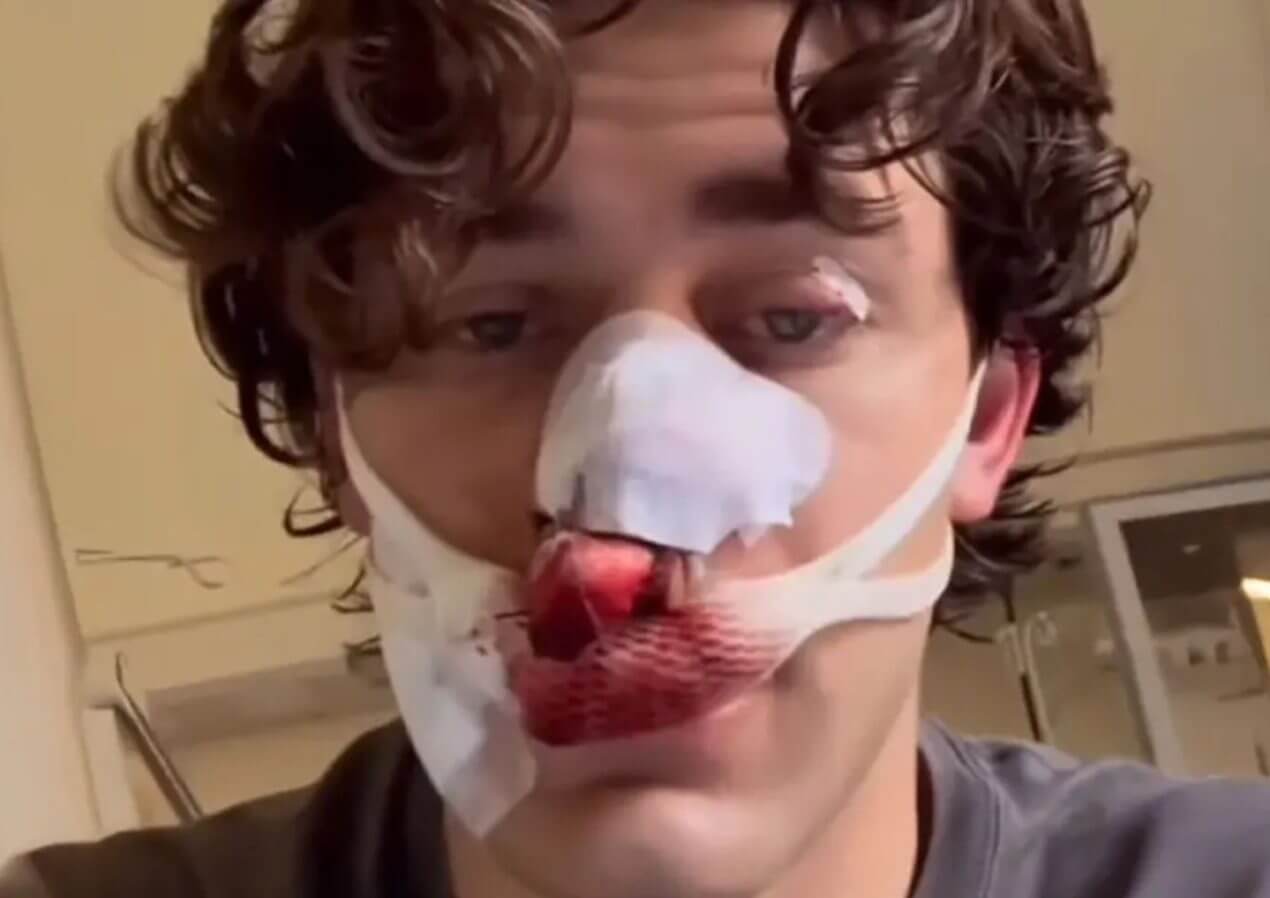 Dresdner Messer-Opfer: „Sie können einfach ins Land kommen und Messer schwingen”